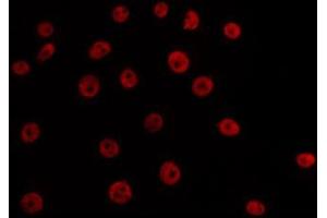 Immunofluorescence (fixed cells) (IF/ICC) image for anti-T-Box 3 (TBX3) antibody (ABIN6265491)