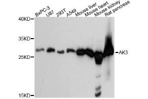 Western blot analysis of extracts of various cell lines, using AK3 antibody. (Adenylate Kinase 3 antibody  (AA 1-227))