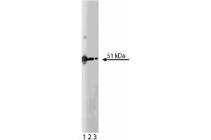 Western blot analysis of PKA[RIIalpha] on K562 lysate. (PKA RIIalpha (AA 1-404) antibody)