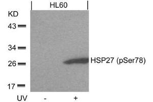 Western blot analysis of extracts from HL60 cells untreated or treated with UV using HSP27(Phospho-Ser78) Antibody. (HSP27 antibody  (pSer78))