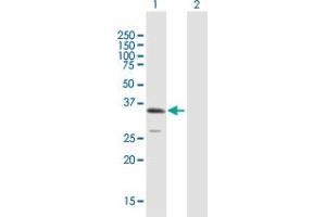 Western Blot analysis of ULBP1 expression in transfected 293T cell line by ULBP1 MaxPab polyclonal antibody. (ULBP1 antibody  (AA 1-244))
