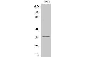 Western Blotting (WB) image for anti-Nanog Homeobox Pseudogene 8 (NANOGP8) (Internal Region) antibody (ABIN3185763) (NANOGP8 antibody  (Internal Region))