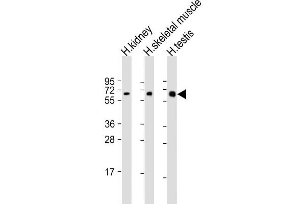 DMRT2 antibody  (AA 357-392)