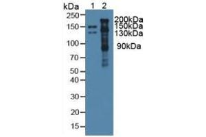 Western Blotting (WB) image for Thrombospondin 1 (THBS1) ELISA Kit (ABIN6574175)