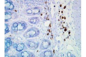 Immunohistochemistry (IHC) image for anti-Heat Shock Protein 90kDa alpha (Cytosolic), Class A Member 1 (HSP90AA1) antibody (ABIN6655033)