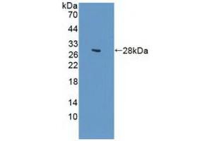 Western blot analysis of recombinant Human GUCY1b3. (GUCY1B3 antibody  (AA 408-619))