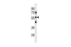 Western blot analysis in NCI-H460 cell line lysates (35ug/lane). (RBMY1D antibody  (C-Term))