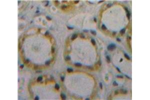 Used in DAB staining on fromalin fixed paraffin-embedded Kidney tissue (CD59 antibody  (AA 26-102))