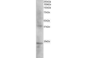 ABIN184618 staining (2µg/ml) of Human Kidney extracts (RIPA buffer, 35µg total protein per lane). (SET/TAF-I antibody  (N-Term))