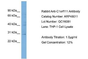 WB Suggested Anti-C1orf111  Antibody Titration: 0. (C1ORF111 antibody  (N-Term))
