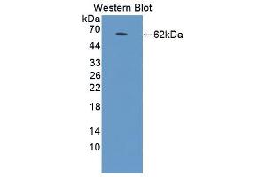 Western blot analysis of the recombinant protein. (STAR antibody  (AA 1-285))