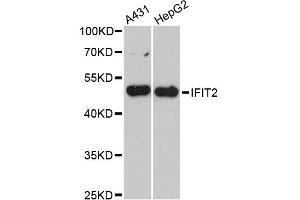 Western blot analysis of extracts of various cell lines, using IFIT2 antibody (ABIN6293343) at 1:3000 dilution. (IFIT2 antibody)