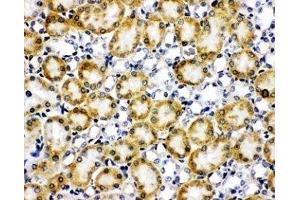 IHC-F testing of Paxillin antibody and rat kidney tissue (Paxillin antibody  (AA 456-472))