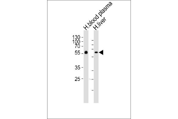 Fetuin A antibody  (C-Term)