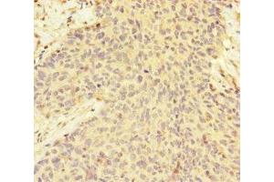 Immunohistochemistry of paraffin-embedded human ovarian cancer using ABIN7165791 at dilution of 1:100 (MAGOH antibody  (AA 1-146))