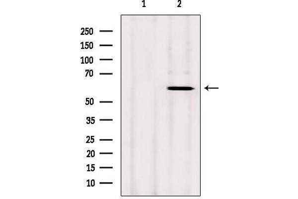 CYP26B1 antibody  (Internal Region)