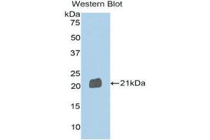 Western Blotting (WB) image for anti-Sema Domain, Immunoglobulin Domain (Ig), Transmembrane Domain (TM) and Short Cytoplasmic Domain, (Semaphorin) 4B (SEMA4B) (AA 192-367) antibody (ABIN1171799) (SEMA4B antibody  (AA 192-367))