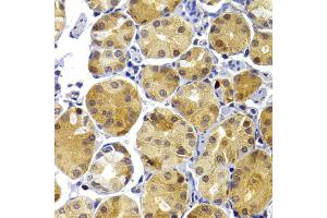 Immunohistochemistry of paraffin-embedded human stomach using TRAF3 antibody (ABIN6292132) at dilution of 1:100 (40x lens). (TRAF3 antibody)