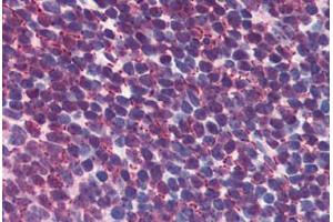 Human Tonsil: Formalin-Fixed, Paraffin-Embedded (FFPE) (CREB1 antibody  (AA 1-342))