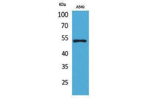 Western Blotting (WB) image for anti-Tumor Protein P53 (TP53) (Tyr216) antibody (ABIN3187854) (p53 antibody  (Tyr216))