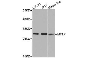 Western blot analysis of extracts of various cell lines, using MTAP antibody. (MTAP antibody  (AA 1-283))