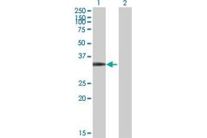 Western Blot analysis of CDK4 expression in transfected 293T cell line by CDK4 MaxPab polyclonal antibody. (CDK4 antibody  (AA 1-303))