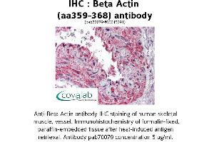 Image no. 1 for anti-Actin, beta (ACTB) (AA 359-368) antibody (ABIN1732309) (beta Actin antibody  (AA 359-368))