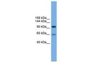 Image no. 1 for anti-Exocyst Complex Component 6 (EXOC6) (AA 287-336) antibody (ABIN6744169) (EXOC6 antibody  (AA 287-336))