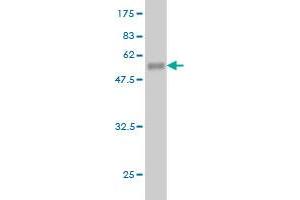 Western Blot detection against Immunogen (50. (PCMT1 antibody  (AA 1-228))