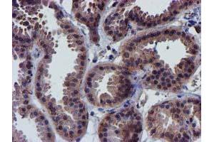 Immunohistochemistry (IHC) image for anti-Coiled-Coil-Helix-Coiled-Coil-Helix Domain Containing 5 (CHCHD5) (AA 1-110) antibody (ABIN1490561) (CHCHD5 antibody  (AA 1-110))