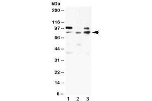 Western blot testing of 1) rat skeletal NRK, 2) human 293T and 3) human MCF7 lysate with ABP1 antibody at 0. (DAO antibody  (AA 144-180))