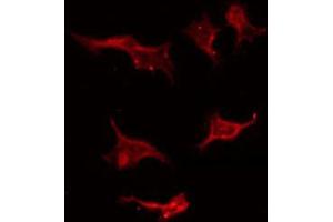 ABIN6267405 staining Hela by IF/ICC. (Stathmin 1 antibody  (pSer25))