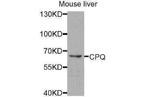 Western blot analysis of extracts of mouse liver, using CPQ antibody (ABIN5974910) at 1/1000 dilution. (CPQ antibody)