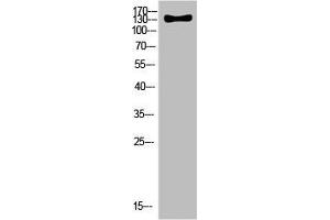 Western Blot analysis of HELA cells using Antibody diluted at 500. (ULK2 antibody  (AA 930-1000))