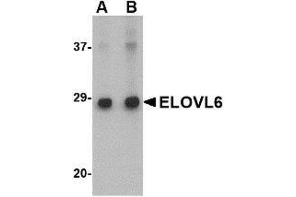 ELOVL6 antibody  (N-Term)
