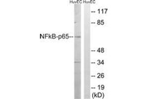 Western Blotting (WB) image for anti-Nuclear Factor-kB p65 (NFkBP65) (AA 247-296) antibody (ABIN2889092) (NF-kB p65 antibody  (AA 247-296))