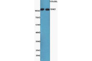 Lane 1: mouse kidney, lysates Lane 2: mouse brain probed with Rabbit Anti-NFkB Inducing Kinase NIK Polyclonal Antibody, Unconjugated  at 1:3000 for 90 min at 37˚C. (MAP3K14 antibody  (AA 901-947))