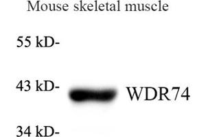 Western blot analysis of WDR74 (ABIN7076220) at dilution of 1: 1000 (WDR74 Antikörper)