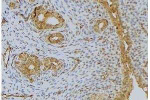 ABIN6276488 at 1/100 staining Human uterus tissue by IHC-P. (DEFB132 antibody)