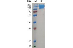 Human MERTK Protein, hFc Tag on SDS-PAGE under reducing condition. (MERTK Protein (AA 21-505) (Fc Tag))