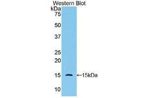 Detection of Recombinant GLG1, Human using Polyclonal Antibody to Golgi Glycoprotein 1 (GLG1) (GLG1 antibody  (AA 1048-1145))