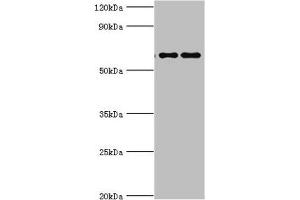 Western blot All lanes: Far upstream element-binding protein 3 antibody at 2 μg/mL Lane 1: Hela whole cell lysate Lane 2: HepG2 whole cell lysate Secondary Goat polyclonal to rabbit IgG at 1/10000 dilution Predicted band size: 62, 29 kDa Observed band size: 62 kDa (FUBP3 antibody  (AA 65-260))