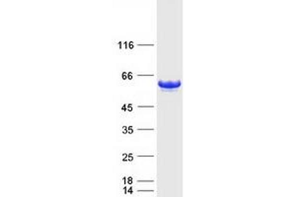 GOPC Protein (Transcript Variant 1) (Myc-DYKDDDDK Tag)