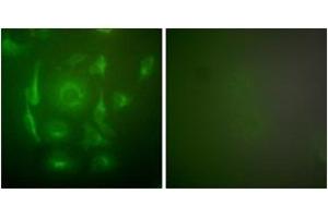Immunofluorescence analysis of HepG2 cells, using Keratin 7 Antibody. (Cytokeratin 7 antibody  (AA 420-469))