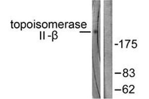 Western Blotting (WB) image for anti-Topoisomerase (DNA) II beta 180kDa (TOP2B) (AA 1-50) antibody (ABIN2889282) (TOP2B antibody  (AA 1-50))