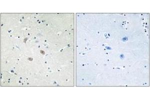Immunohistochemistry (IHC) image for anti-V-Akt Murine Thymoma Viral Oncogene Homolog 2 (AKT2) (AA 432-481) antibody (ABIN2888944) (AKT2 antibody  (AA 432-481))