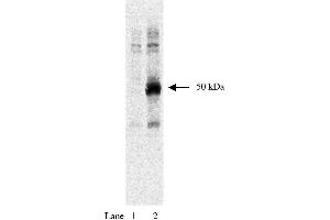 Western blot using anti-HA tag antibody  and HEK293 cells expressing HA-tagged Rem protein at 1:1000 dilution. (HA-Tag antibody)