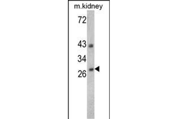 Endonuclease G antibody  (C-Term)