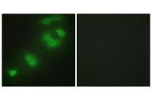 Immunofluorescence analysis of HepG2 cells, using CREBZF antibody. (CREBZF antibody)