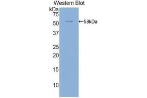 Western Blotting (WB) image for anti-Activated Leukocyte Cell Adhesion Molecule (ALCAM) (AA 28-527) antibody (ABIN1171900) (CD166 antibody  (AA 28-527))